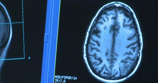 Trial shows poliovirus may be effective in treating deadly brain cancer