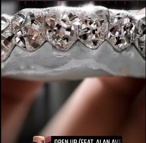 These are called "Stone Mountain " Gold , WhiteGold, & Rose Gold! l | Atlanta Custom Gold Grills and Jewelry | Facebook