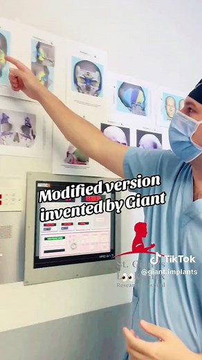 Orbital Box Osteotomy: Safe Eye Reshaping Procedure