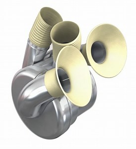 An artificial heart with a magnetically suspended impeller that rotates 2,000 times per minute to pump blood