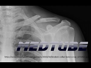 How to read an Orthopedic Radiograph