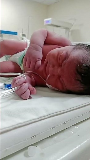 Title: NICU Newborn Baby with RDS: A Painful and Critical Condition 💔👶🫁 #rrt s