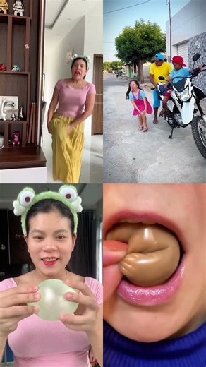 Adu suara bareng Canal Kimberlly e Kyann, Cool Items and my suara koper koperan 🦵🤕🎈