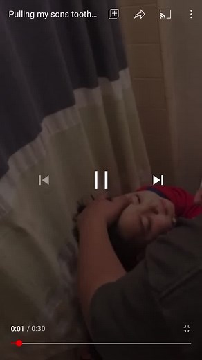 Getting tooth pulled out#fyp #forupqge #viral