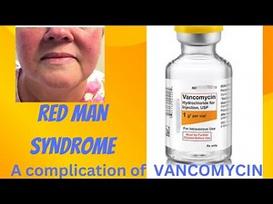 RED MAN SYNDROME........ A COMPLICATION OF VANCOMYCIN INFUSION