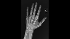 Medical Devices & Hospital Consumables