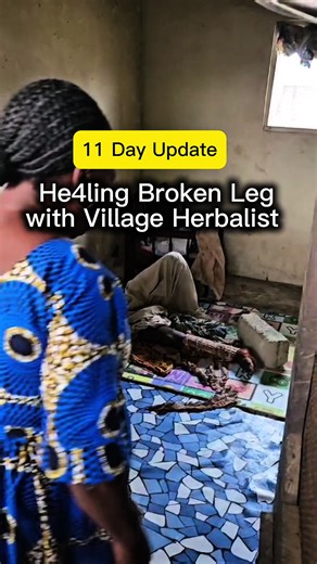 Natural Healing: Enhancing Recovery with Herbs