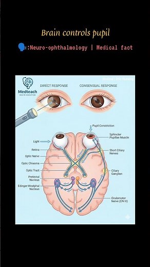 How Eye Responds to Light? | Pupillary Light Reflex Explained #youtubeshorts #visiontherapy