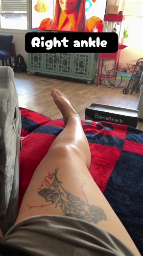 Facing My First Broken Bone at 30