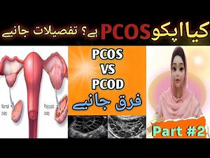 What is Polycystic Ovarian Syndrome: Causes, Symptoms & Diagnosis | How to Manage PCOD & PCOS