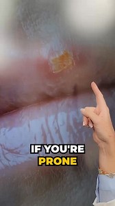 The Best Cold Sore Hack // Get fast and effective cold sore relief in just minutes with these powerful remedies! In this video, Dr. Janine shares the best natural hack to help you say goodbye to painful cold sores and hello to a healthier, happier you. From reducing inflammation to accelerating the healing process, Dr. Janine’s got you covered. Watch until the end to discover the top cold sore relief secrets that will change your life! | Janine Bowring