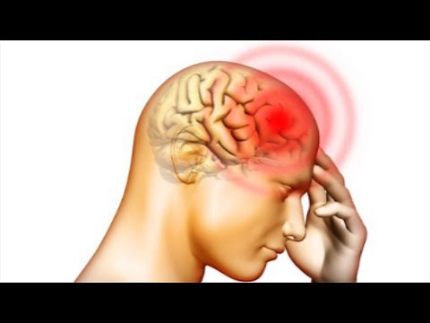 Top 10 Deadliest Diseases Of All Time