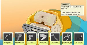 Virtual Knee Surgery | Play the Game for Free on PacoGames