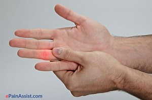 Paggamot sa Pinsala sa Kamay: Impormasyon sa Unang Pananagutan para sa Mga Pinsala sa Kamay - First-Aid - Emerhensiya 2026