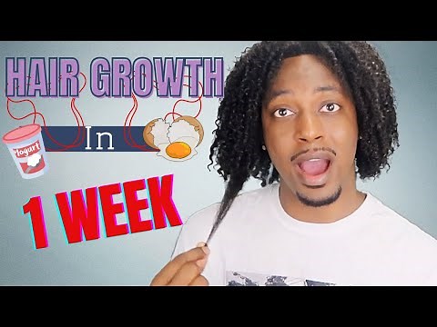 How To Make Your Hair Grow Faster In 1 Week | WINSTONEE