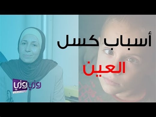 أسباب كسل العين وطرق اكتشافه