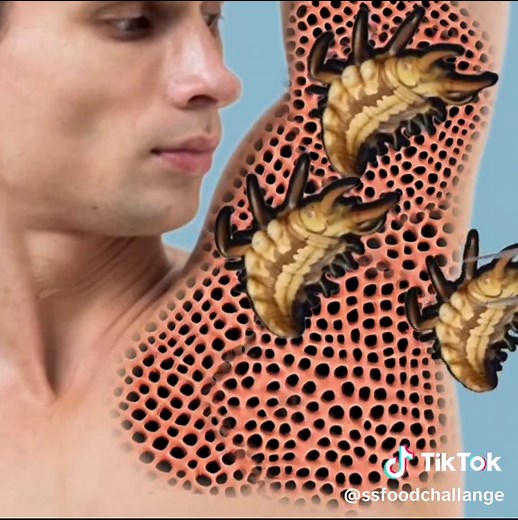 #asmr #asmrsurgery #asmrtreatment #foryou