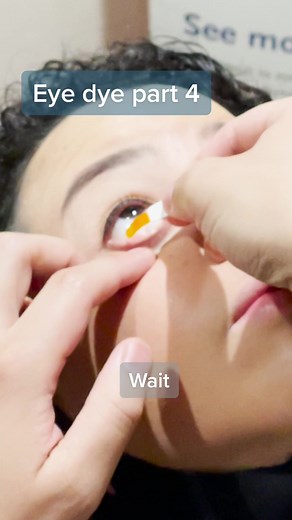 Dye in the Eye Part 4 - Optometry Insights