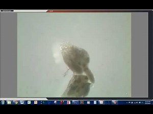 Drosophila Ovary Dissection