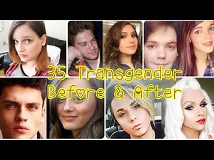 35 Transgender Before & After