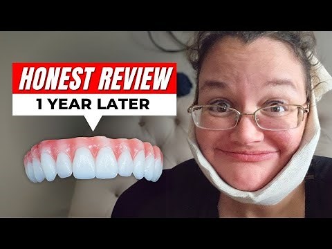 What I Wish I Knew About the Downsides Before Getting Dental Implants…