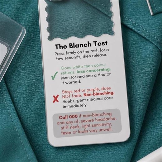 Blanch Test Keyring — Parent Rash Safety Guide - Etsy Australia