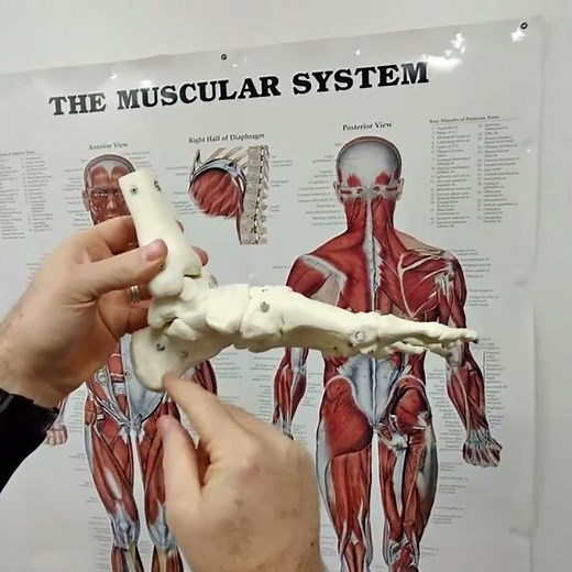 Stop Heel Pain Now: Discover How Arch Support Can Help #FootHealth #HeelPain