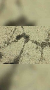 Viruses: How They Invade Cells and Shape Life