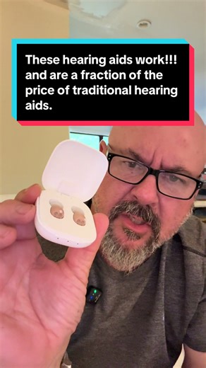 Affordable Audial One Hearing Aids for Hearing Loss