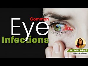Common Eye Infections - Conjunctivitis, Pink Eye, Stye, Viral Eye Infections | Dr. Anita Sehgal