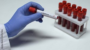 Positive C diphtheriae test, doctor showing blood sample in tube, lab research