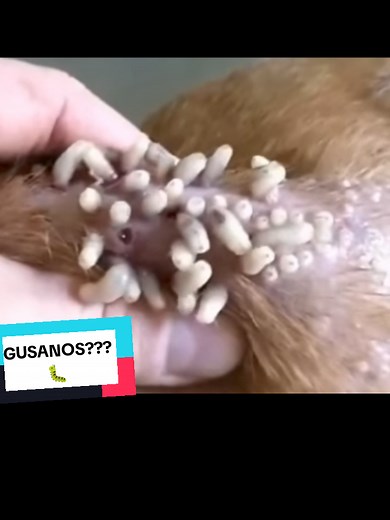 Gusanos y su Extracción: Un Debate Impactante