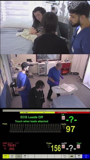 🍼 Pyloric Stenosis Simulation | Infant Vomiting & Dehydration Scenario