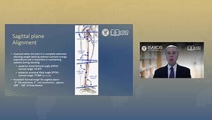 Physiological Axes of the Lower Limb