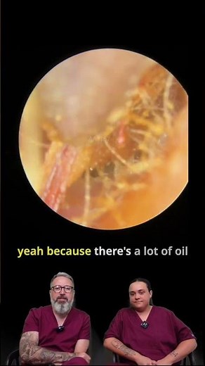 Why Peroxide Drops Fizz in Your Ears! 👂💥 #EarWaxRemoval Explained by Audiologist