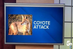 Why Predator Hunting Matters: 4-Year-Old Attacked By Coyote