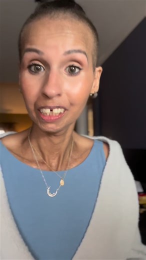 Most Scleroderma warriors have GI involvement. Unfortunately for me, mine is becoming increasingly severe. We are doing a procedure January 7th to try and improve the rate my stomach empties at. Just another adventure that Scleroderma is taking me on 🥰💜 | Sheshutesshescores