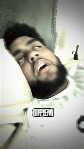 Sleeping but eyes are open, why is that? 😧