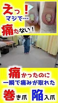 "Wait, it really doesn't hurt!" For those afraid to walk due to ingrown toenails: "My big toe hur...