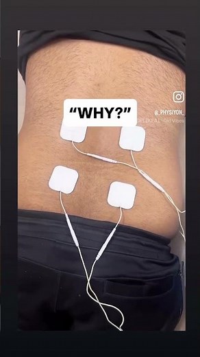 What is this therapy? (TENS explained)This is TENS – Transcutaneous Electrical Nerve Stimulation.