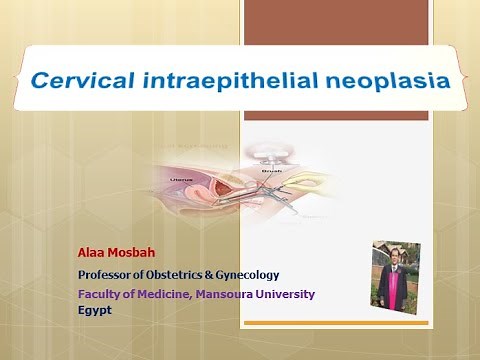 Cervical intraepithelial neoplasia