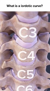 6.9K views · 62 reactions | Use this quick video to understand what a lordotic curve is in the spine and why it’s essential for healthy posture and spinal balance. Learn how this natural inward curve in your lower back supports movement, helps prevent back pain, and what happens when the curve becomes too flat or too exaggerated. Great for anyone researching spine alignment, posture correction, or lordosis treatment. #spinehealth #LordoticCurve | Spine-health | Facebook