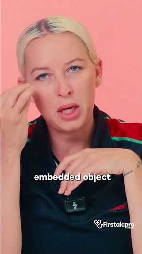 🛑 Do NOT pull that object out! (Read this before you touch your eye) 👁️