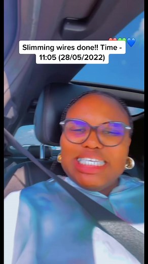 Slimming Wires Journey: Before and After Transformation