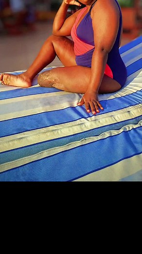 ✅️Many times the disabled are expected to behave,dress,live in some certain way by the society. ✅️Normal things that physically abled beings do comfortably or without questioning becomes an area of concern when the disabled participate in the same. ✅️The sooner we realise we are all entitled to doing whatever and whenever, the sooner the disabled will maximise full potentials and stop hiding. ✅️Stop stigma..let's make disability a norm.