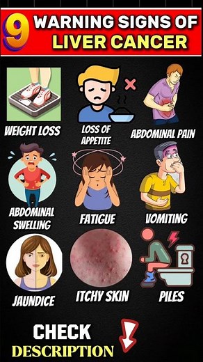 9 Warning Signs of Liver Cancer You Shouldn't Ignore