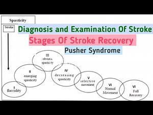 Diagnosis And Examination Of Stroke||Stages Of Stroke Recovery||Pusher Syndrome