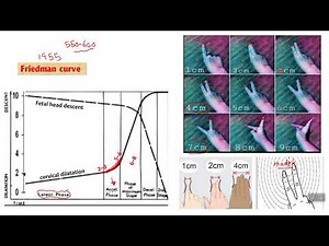 Normal labor / part 4