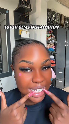 Tooth Gem Installation Tutorial: Everything You Need to Know