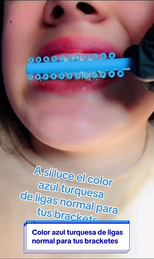 Azul Turquesa: Color de Ligas Normal para tus Brackets